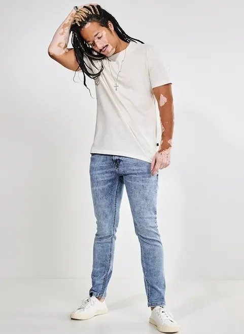 calça jeans skinny marmorizada calça jeans skinny marmorizada